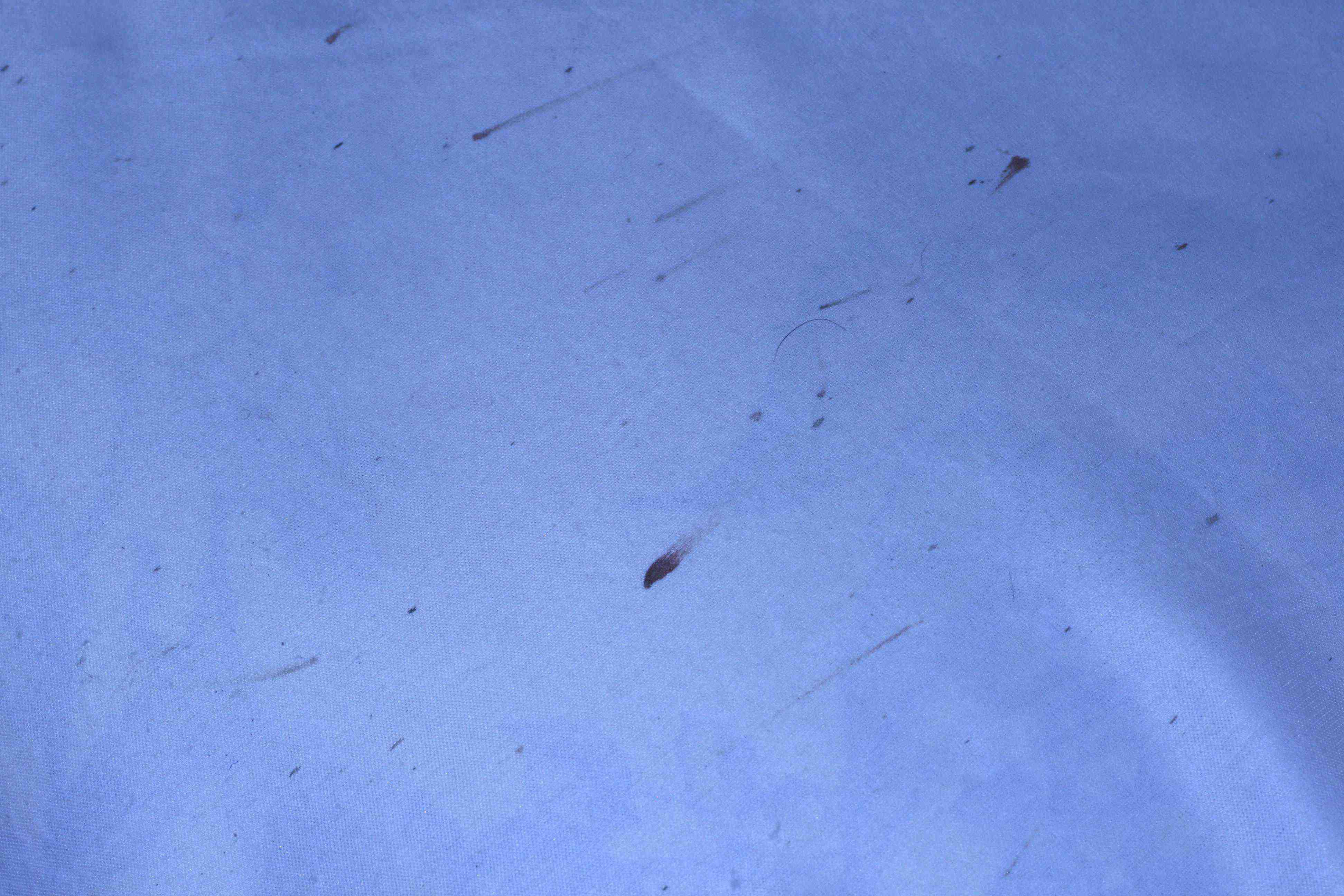 Blood Smears